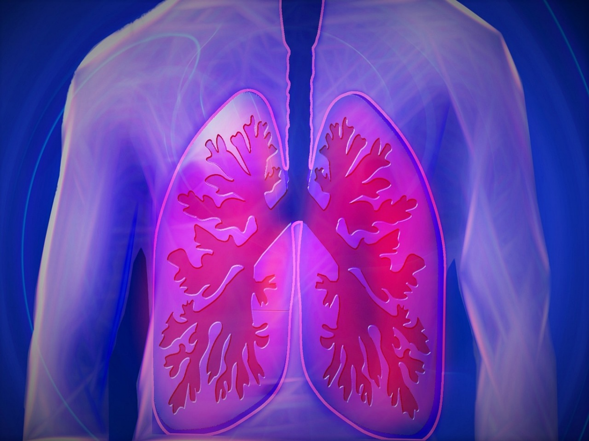 Lung cancer screening for smokers